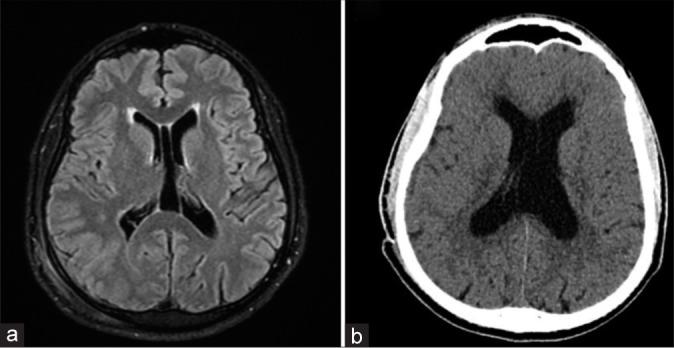 https://cdn.ncbi.nlm.nih.gov/pmc/blobs/84c3/11021098/fbca7b9becfa/SNI-15-89-g006.jpg