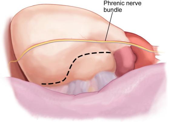 https://cdn.ncbi.nlm.nih.gov/pmc/blobs/84c3/11267342/6b9613e0352c/2153-8174-23-10-338-g4.jpg