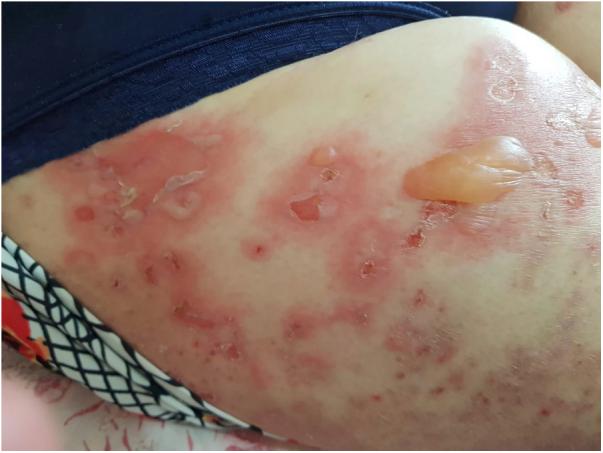 https://cdn.ncbi.nlm.nih.gov/pmc/blobs/84c3/11342994/50d7f25a1f77/gr1.jpg