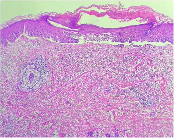 https://cdn.ncbi.nlm.nih.gov/pmc/blobs/84c3/11342994/d303cfb39e76/gr3.jpg