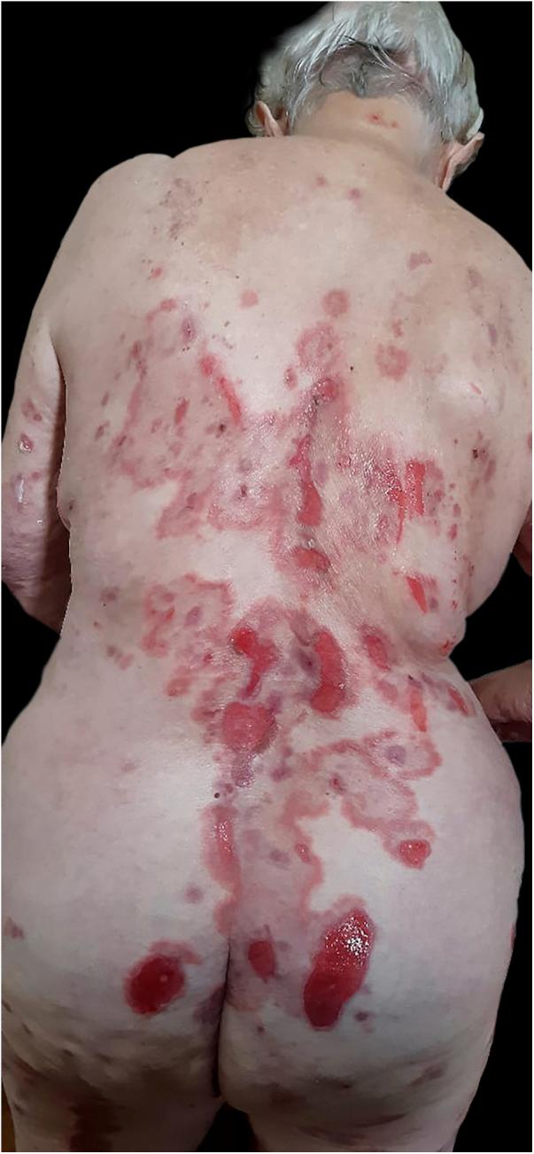https://cdn.ncbi.nlm.nih.gov/pmc/blobs/84c3/11342994/f0733f71a5d2/gr2.jpg