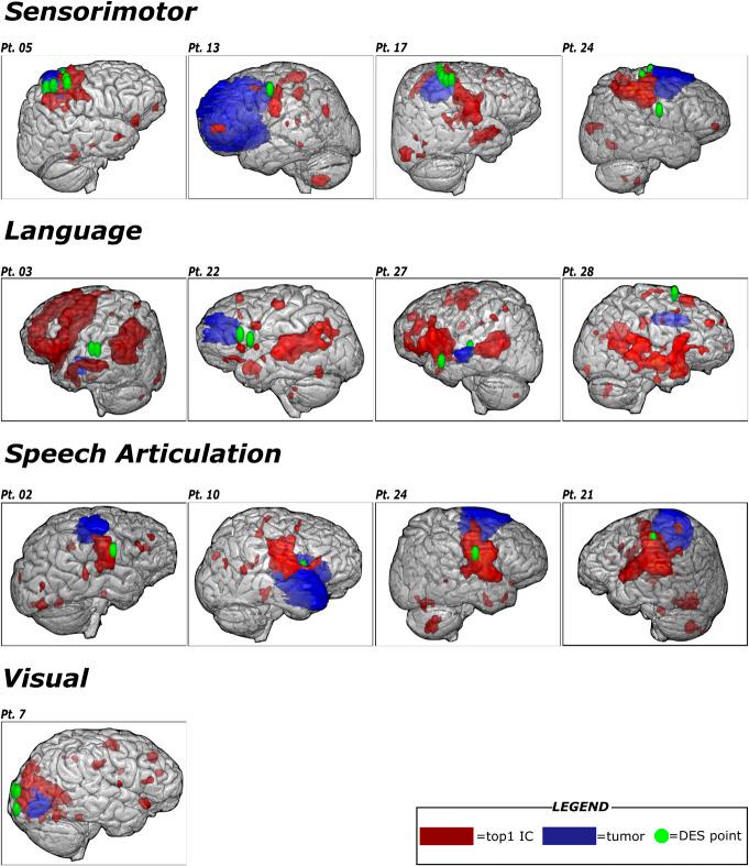 https://cdn.ncbi.nlm.nih.gov/pmc/blobs/84c8/11540433/d608de07b8e6/neu-95-1358-g004.jpg