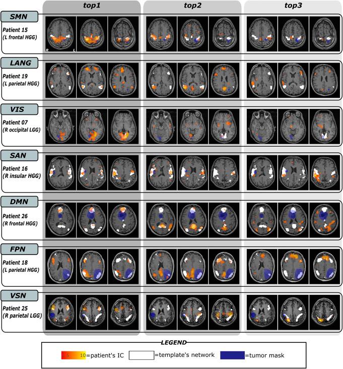 https://cdn.ncbi.nlm.nih.gov/pmc/blobs/84c8/11540433/f108e91d75b1/neu-95-1358-g002.jpg