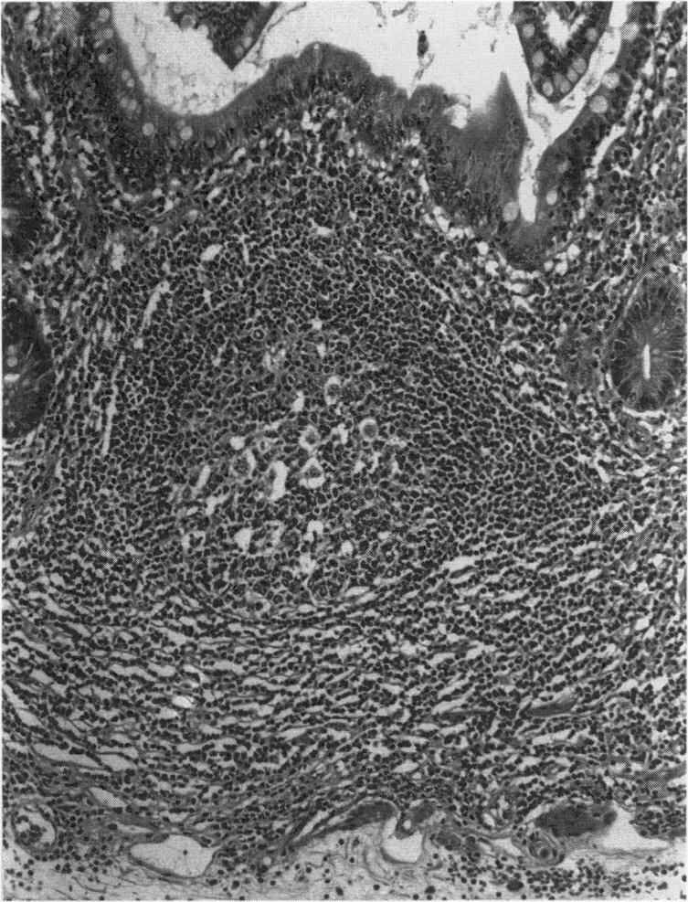 https://cdn.ncbi.nlm.nih.gov/pmc/blobs/84c9/2588981/5a7d97cf721d/yjbm00031-0066-a.jpg