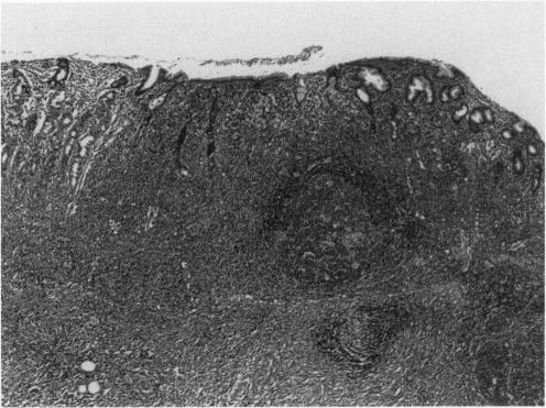 https://cdn.ncbi.nlm.nih.gov/pmc/blobs/84c9/2588981/a70b0350d394/yjbm00031-0065-a.jpg