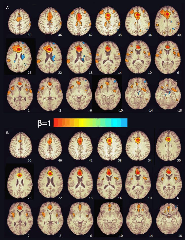 https://cdn.ncbi.nlm.nih.gov/pmc/blobs/84c9/7509409/d83ca1b455a0/fneur-11-00952-g0002.jpg