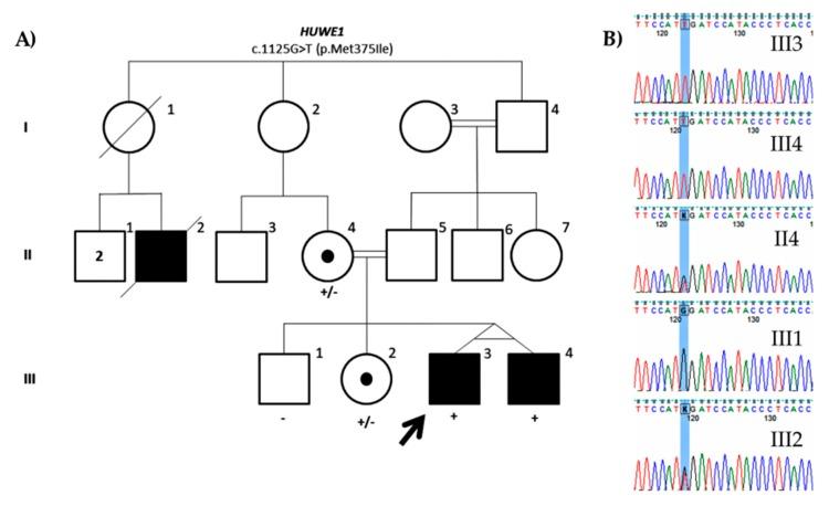 https://cdn.ncbi.nlm.nih.gov/pmc/blobs/84ca/7017351/01b437db12d2/genes-11-00051-g005.jpg