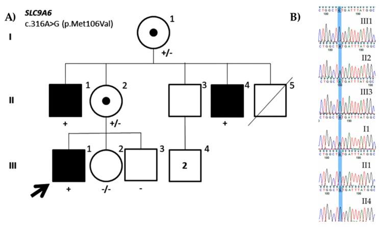 https://cdn.ncbi.nlm.nih.gov/pmc/blobs/84ca/7017351/4ed78d8af920/genes-11-00051-g004.jpg