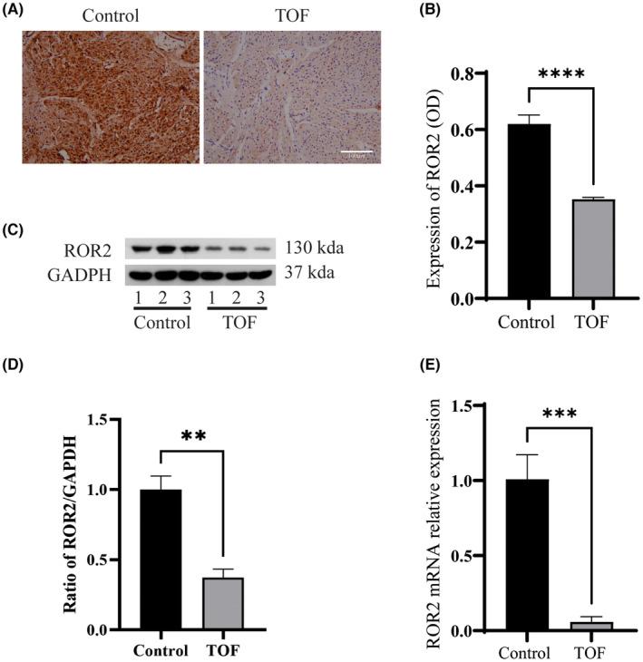https://cdn.ncbi.nlm.nih.gov/pmc/blobs/84d1/10660643/1de6166f4b56/JCMM-27-3539-g004.jpg