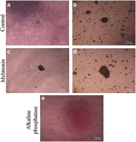 https://cdn.ncbi.nlm.nih.gov/pmc/blobs/84d3/5646105/a117bdb77e31/13287_2017_687_Fig3_HTML.jpg