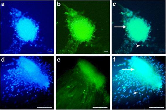 https://cdn.ncbi.nlm.nih.gov/pmc/blobs/84d3/5646105/d09702cd871c/13287_2017_687_Fig4_HTML.jpg