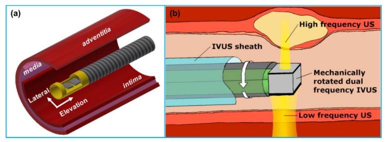 https://cdn.ncbi.nlm.nih.gov/pmc/blobs/84db/8160965/96bbcf929604/sensors-21-03540-g006.jpg