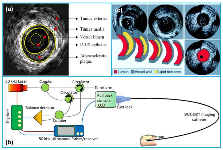 https://cdn.ncbi.nlm.nih.gov/pmc/blobs/84db/8160965/c51719af049c/sensors-21-03540-g001.jpg