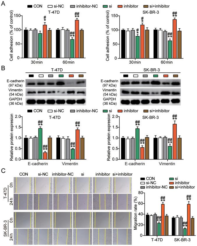 https://cdn.ncbi.nlm.nih.gov/pmc/blobs/84e5/8299007/ac20bf42b762/ol-22-03-12921-g05.jpg