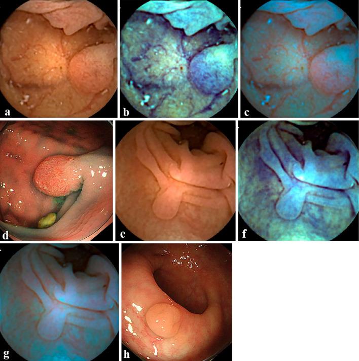 https://cdn.ncbi.nlm.nih.gov/pmc/blobs/84eb/8263190/bf064e46dcb4/1349-7235-60-1805-g003.jpg
