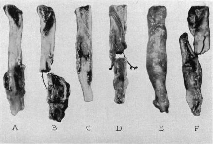 https://cdn.ncbi.nlm.nih.gov/pmc/blobs/84ed/1385702/2c6d75a741f4/annsurg00387-0133-a.jpg