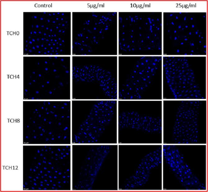 https://cdn.ncbi.nlm.nih.gov/pmc/blobs/84ef/11763077/359641380647/41598_2025_87988_Fig14_HTML.jpg