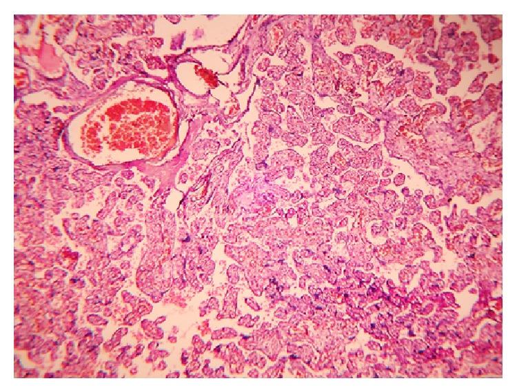 https://cdn.ncbi.nlm.nih.gov/pmc/blobs/84f1/4260367/ef754258c9c9/JP2014-193925.002.jpg