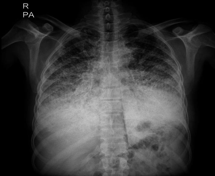 https://cdn.ncbi.nlm.nih.gov/pmc/blobs/84f2/12329359/411545c00951/cjim-16-3-570-g001.jpg
