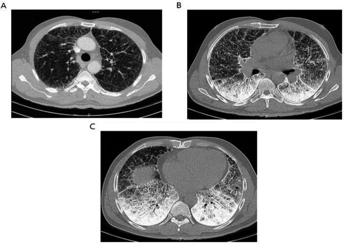 https://cdn.ncbi.nlm.nih.gov/pmc/blobs/84f2/12329359/787f28d3501c/cjim-16-3-570-g002.jpg