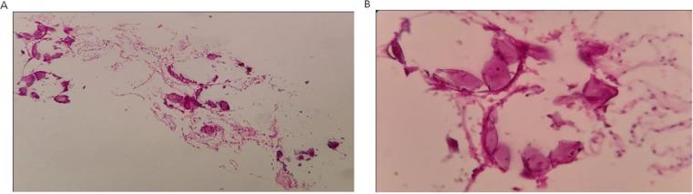 https://cdn.ncbi.nlm.nih.gov/pmc/blobs/84f2/12329359/92c7d1ce3c3c/cjim-16-3-570-g003.jpg