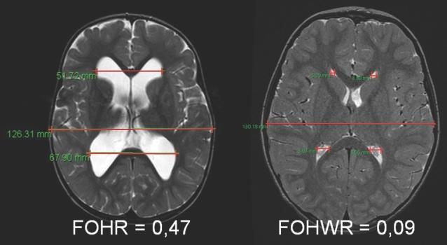 https://cdn.ncbi.nlm.nih.gov/pmc/blobs/84f6/6140776/e95710dacbc9/nyx420fig4.jpg