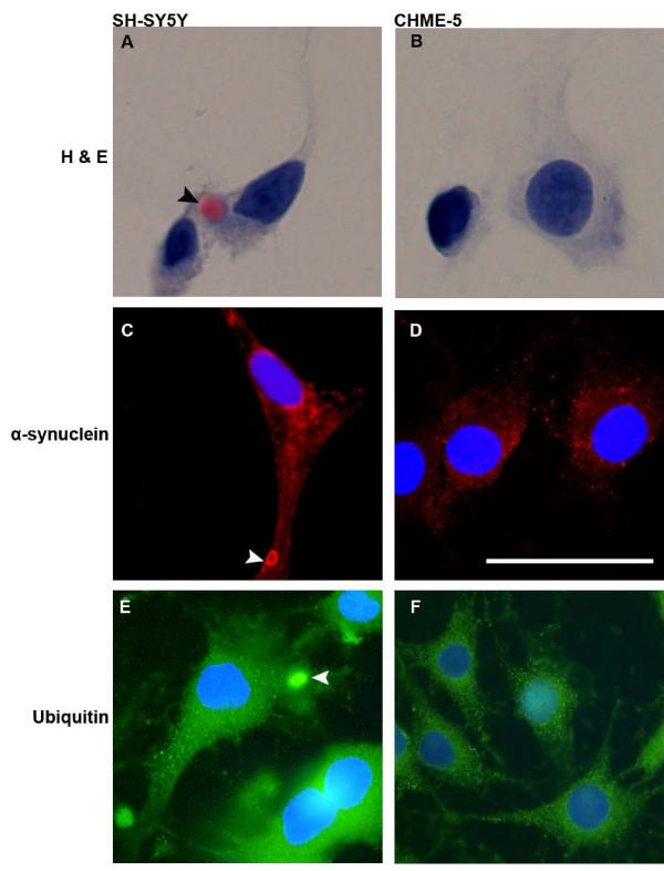 https://cdn.ncbi.nlm.nih.gov/pmc/blobs/84f8/2806357/d4c002fba474/1750-1326-4-55-1.jpg