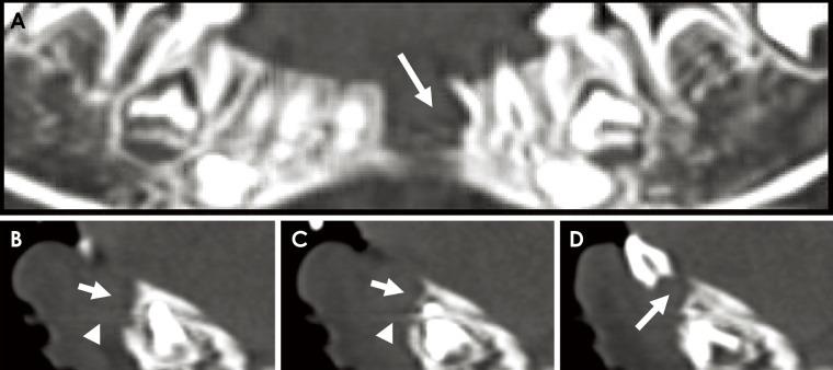 https://cdn.ncbi.nlm.nih.gov/pmc/blobs/84ff/5620466/a50a76d56339/isd-47-209-g004.jpg