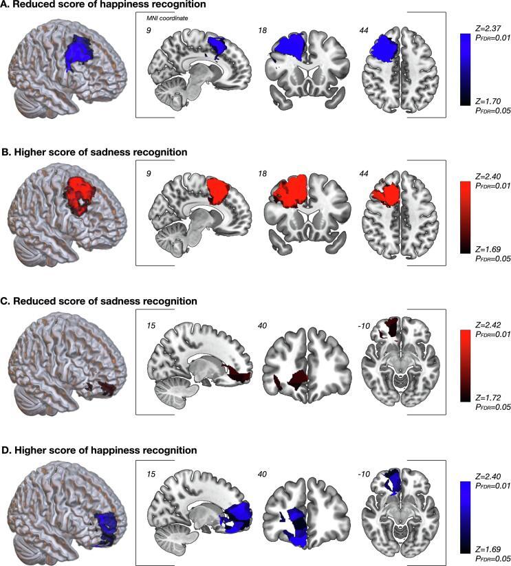 https://cdn.ncbi.nlm.nih.gov/pmc/blobs/8500/9192961/7a01fa623b04/gr2.jpg