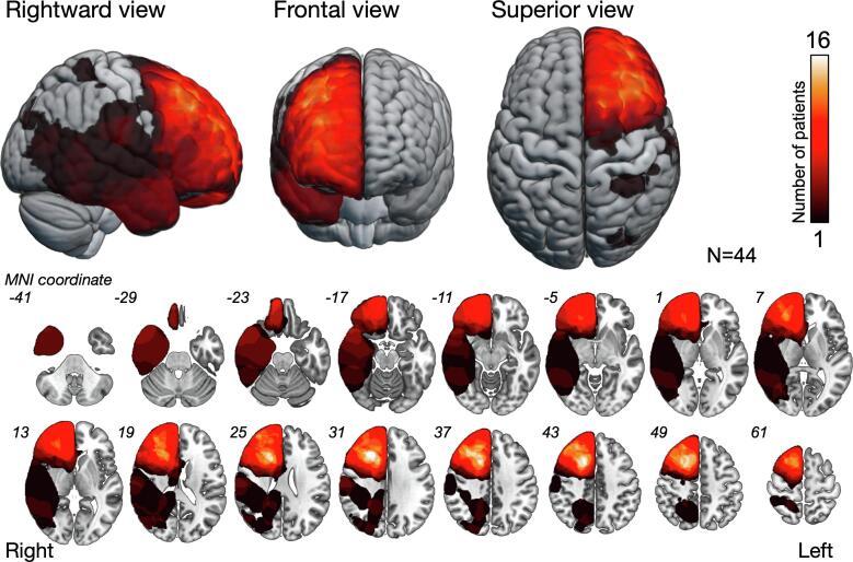 https://cdn.ncbi.nlm.nih.gov/pmc/blobs/8500/9192961/ee7803a4880f/gr1.jpg