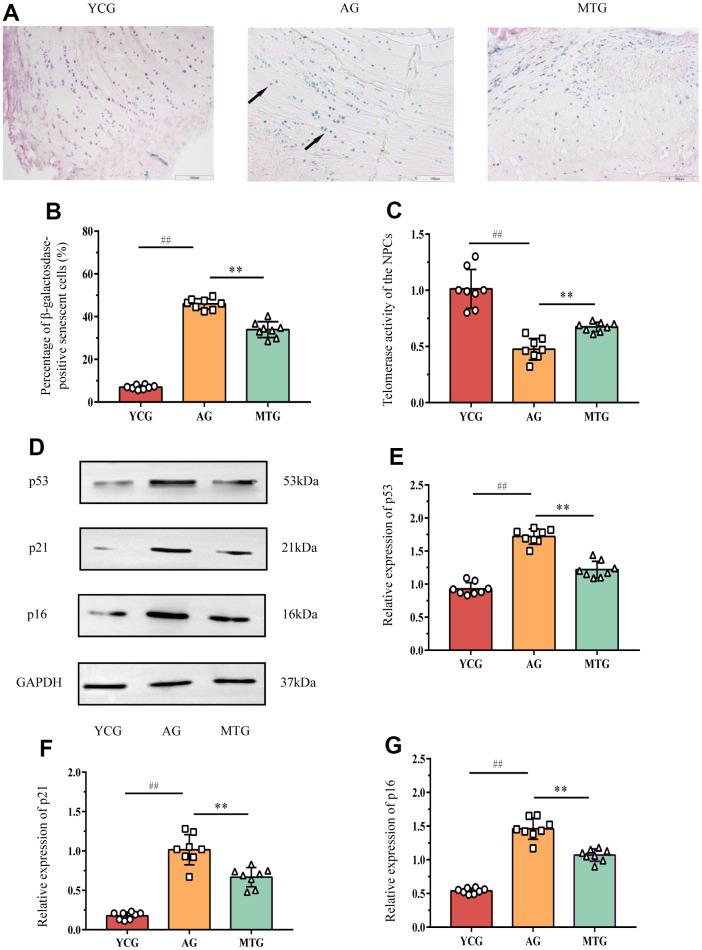 https://cdn.ncbi.nlm.nih.gov/pmc/blobs/8502/8954973/bc73a59099c3/aging-14-203949-g004.jpg