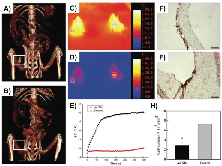 https://cdn.ncbi.nlm.nih.gov/pmc/blobs/8503/5646719/ac2fb21cca53/ntnov01p0166g003.jpg