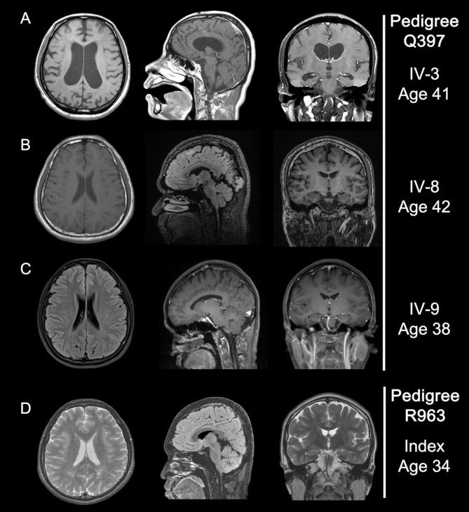 https://cdn.ncbi.nlm.nih.gov/pmc/blobs/8504/12042469/c6e56e2c1528/13195_2025_1744_Fig2_HTML.jpg
