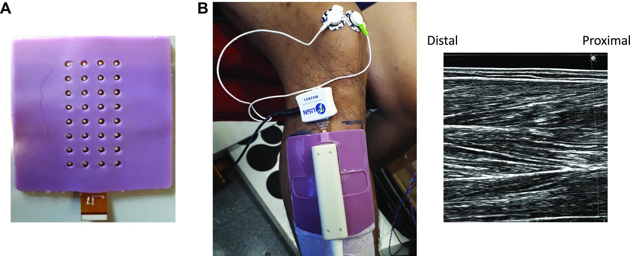 https://cdn.ncbi.nlm.nih.gov/pmc/blobs/8506/9639771/7600b54bcedd/japplphysiol.00758.2021_f002.jpg