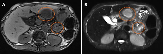 https://cdn.ncbi.nlm.nih.gov/pmc/blobs/8507/8409187/360108744bb1/WJCC-9-7224-g002.jpg