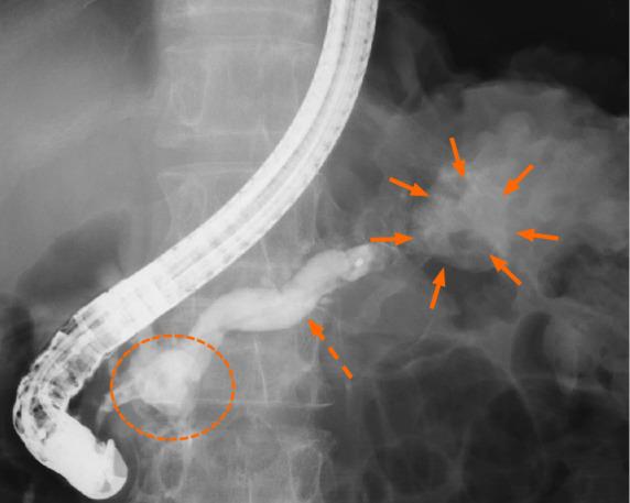 https://cdn.ncbi.nlm.nih.gov/pmc/blobs/8507/8409187/5e67a6fe15f2/WJCC-9-7224-g003.jpg