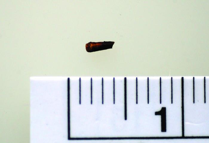 https://cdn.ncbi.nlm.nih.gov/pmc/blobs/8508/2075582/1aa21aaa8f94/umj7603-164-f1.jpg