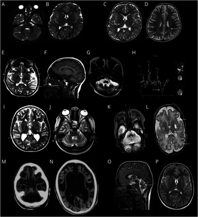 https://cdn.ncbi.nlm.nih.gov/pmc/blobs/8514/11595325/a9e99d63662e/NXG-2024-100124f3.jpg