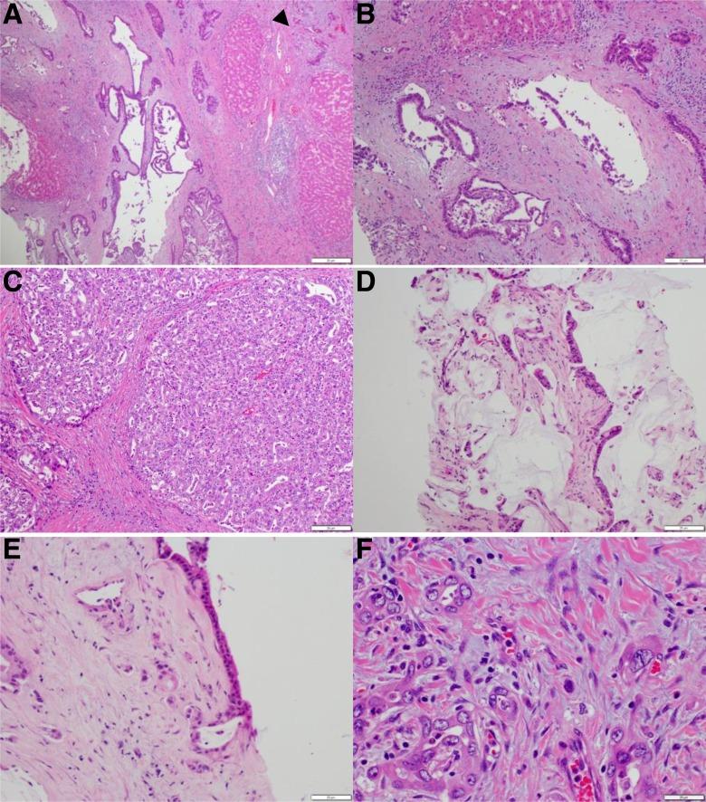 https://cdn.ncbi.nlm.nih.gov/pmc/blobs/8515/5933592/03512035ff37/10.1177_1073274817744625-fig12.jpg
