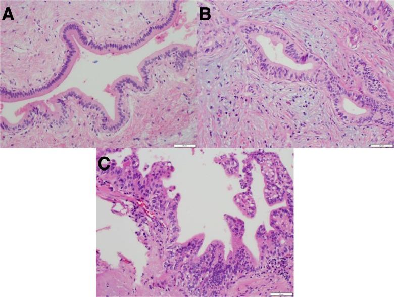 https://cdn.ncbi.nlm.nih.gov/pmc/blobs/8515/5933592/07eb491bed98/10.1177_1073274817744625-fig3.jpg