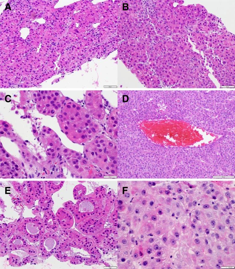 https://cdn.ncbi.nlm.nih.gov/pmc/blobs/8515/5933592/26c51b01288c/10.1177_1073274817744625-fig5.jpg
