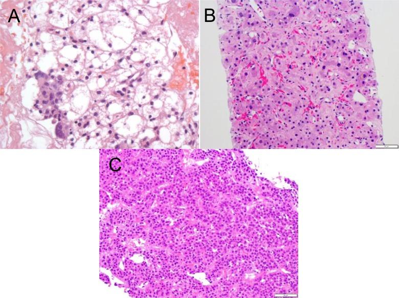 https://cdn.ncbi.nlm.nih.gov/pmc/blobs/8515/5933592/a03841af28e2/10.1177_1073274817744625-fig6.jpg