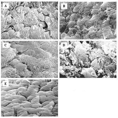 https://cdn.ncbi.nlm.nih.gov/pmc/blobs/8516/2194694/3968d2dce63e/1465-9921-8-83-4.jpg