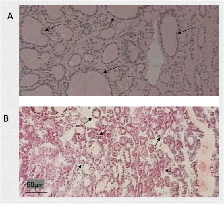 https://cdn.ncbi.nlm.nih.gov/pmc/blobs/8517/11914986/bdb685254aaf/gr1.jpg