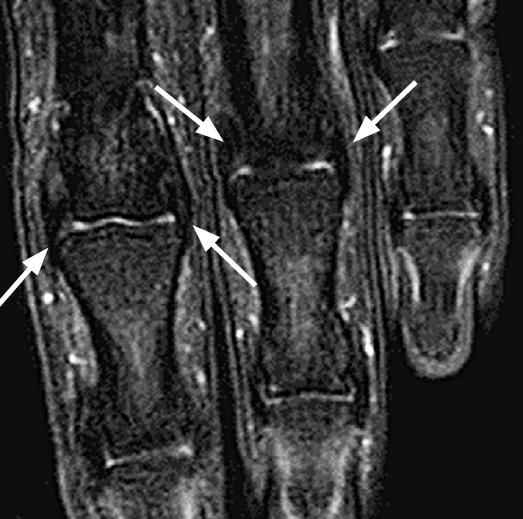 https://cdn.ncbi.nlm.nih.gov/pmc/blobs/8518/4825212/0eb33d846b66/usg-15051-f20.jpg