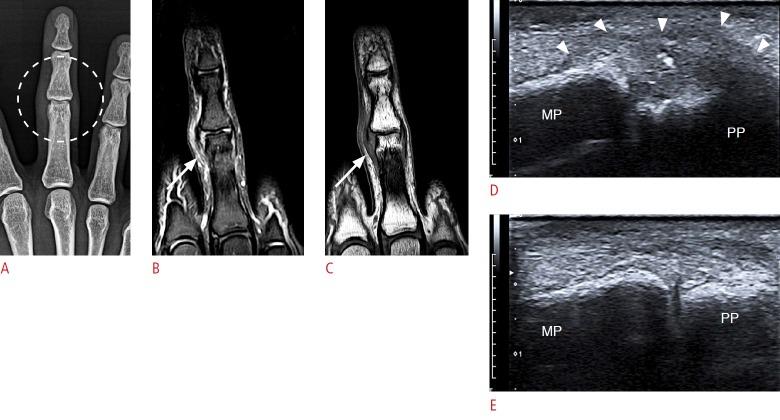 https://cdn.ncbi.nlm.nih.gov/pmc/blobs/8518/4825212/8a2b6e011cac/usg-15051-f21.jpg