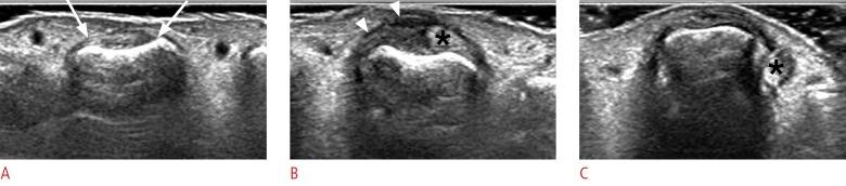 https://cdn.ncbi.nlm.nih.gov/pmc/blobs/8518/4825212/c666177dfc01/usg-15051-f4.jpg