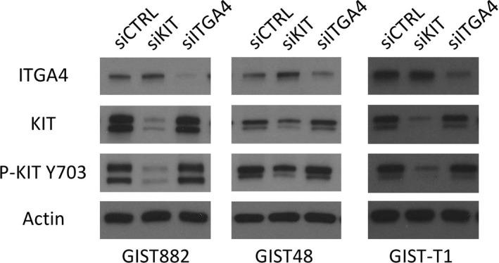 https://cdn.ncbi.nlm.nih.gov/pmc/blobs/851b/5867167/f6f75d2756c2/JCMM-22-2220-g003.jpg