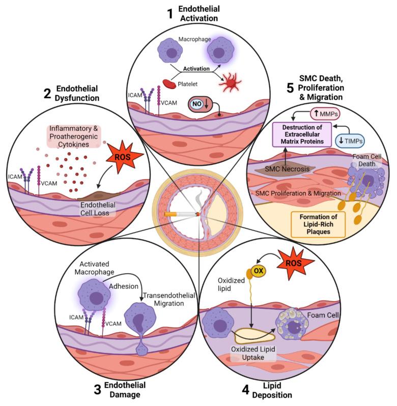 https://cdn.ncbi.nlm.nih.gov/pmc/blobs/851c/9600209/4cfd815f25b3/cells-11-03190-g001.jpg