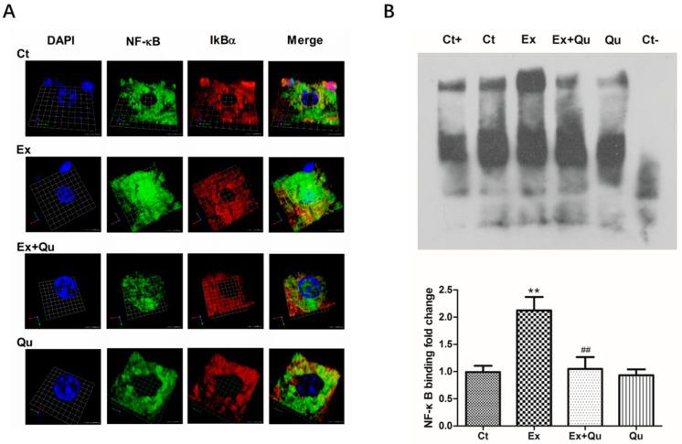 https://cdn.ncbi.nlm.nih.gov/pmc/blobs/851f/7551556/08b77dad80b5/nutrients-12-02770-g006.jpg